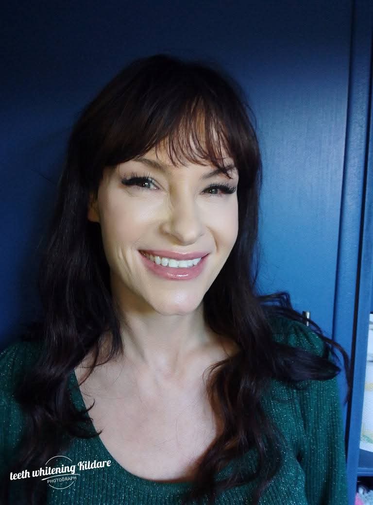 Real Lumiere client smile