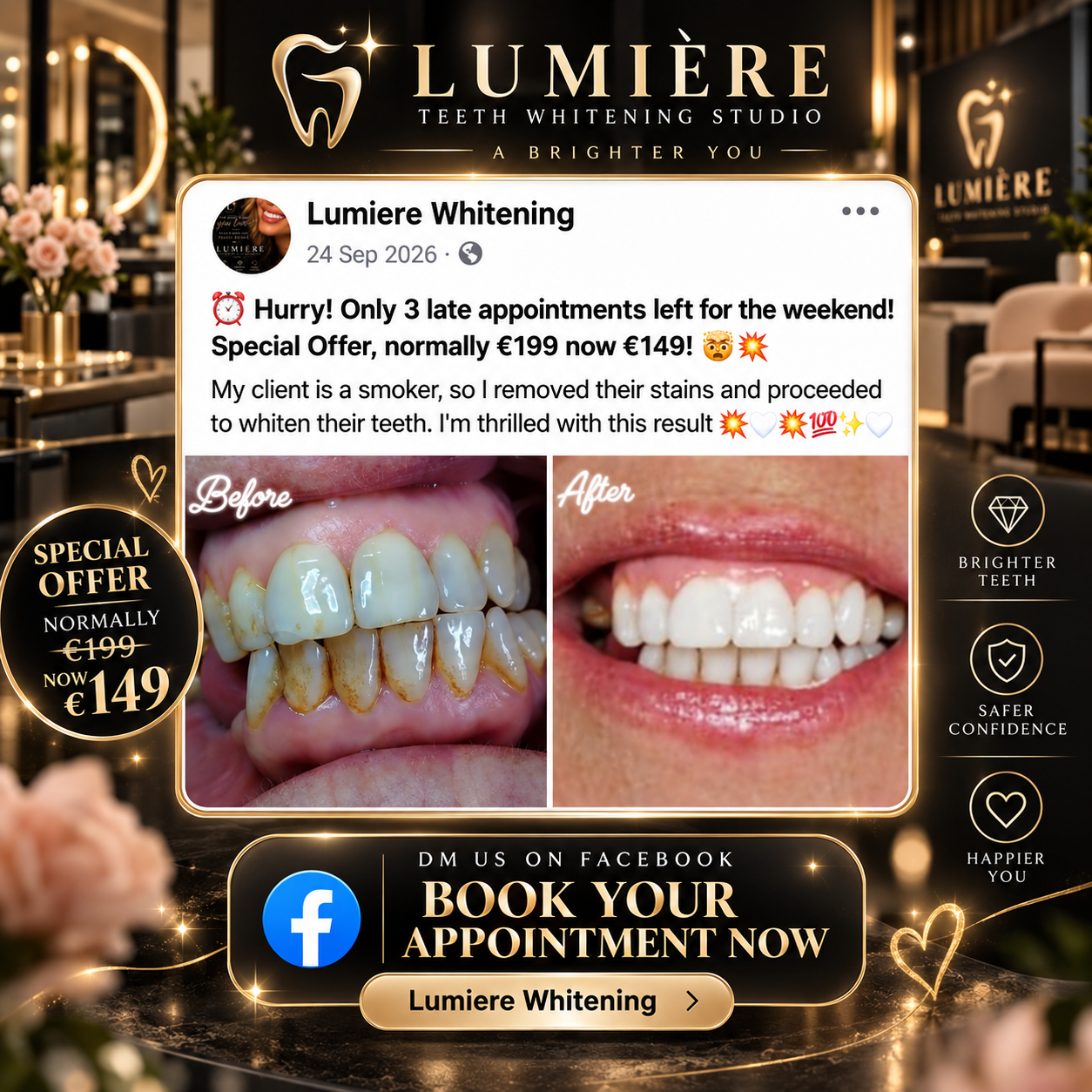 Lumiere special offer: normally €199, now €149 — before and after whitening for a smoker's stained teeth. Book on Facebook.